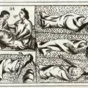 Florentine Codex small pox.